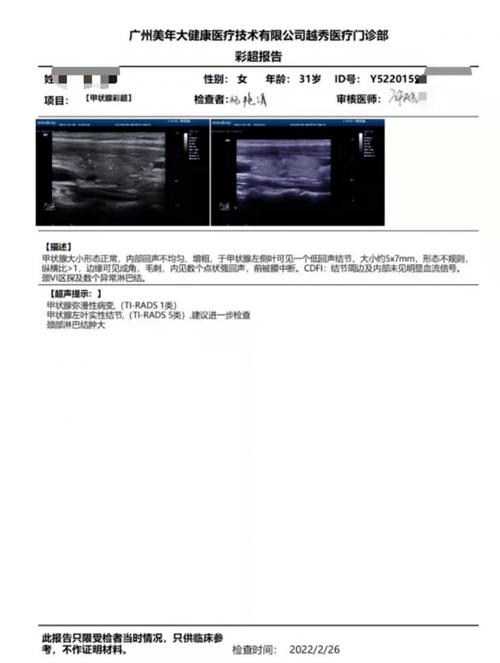 VPRADS1类B超，能否进行检测？插图