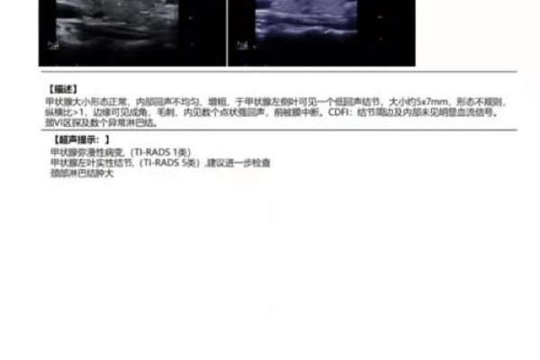 VPRADS1类B超，能否进行检测？-百挑一